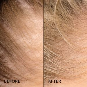 Сироватка M2 Beaute Hair Activating Serum проти випадіння волосся